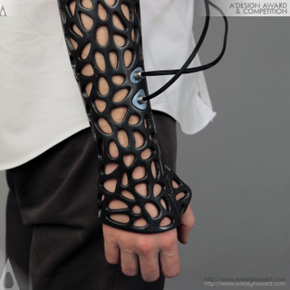 Illustration for article titled Una escayola impresa 3D y con ultrasonidos para fracturas del futuro